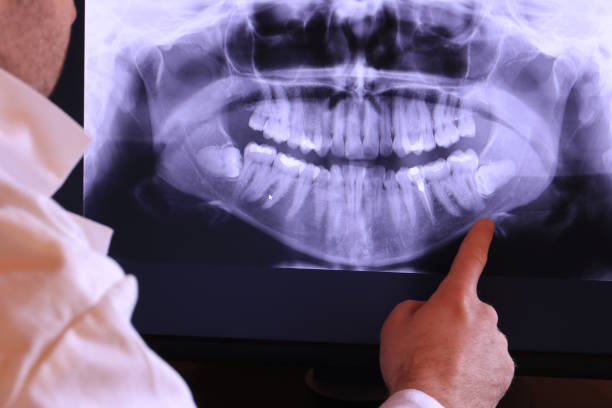 Best Dental Abscess Treatment in North Palm Beach, FL